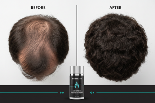 Dark Brown Hair Building Fibres - 27.5g - Instant Thicker Hair